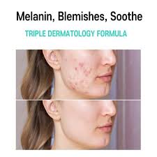 Anti Melasma Cica Cream