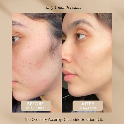 The Ordinary Ascorbyl Glucoside Solution 12%
