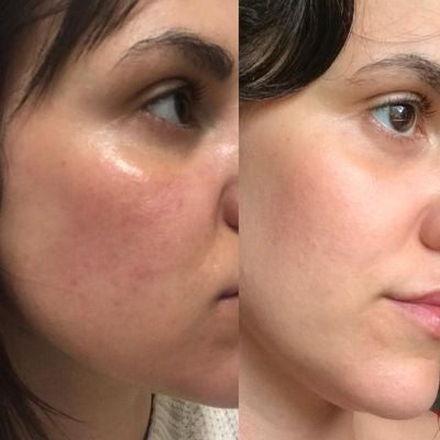 The Ordinary Ascorbyl Glucoside Solution 12%